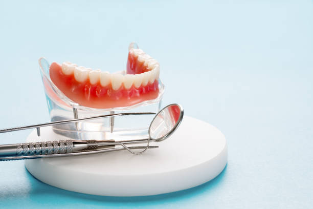 Best Dental Inlays and Onlays  in San Marino, CA
